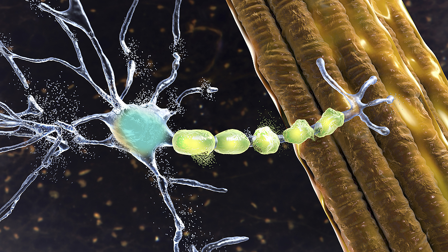 How Spinal Cord Stimulators Work in Sherman TX