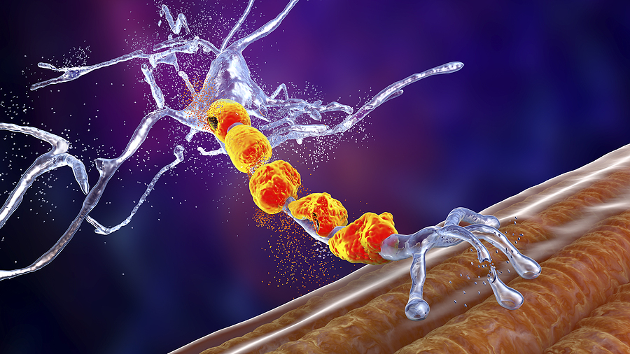 Symptoms of Peripheral Neuropathy Sherman TX