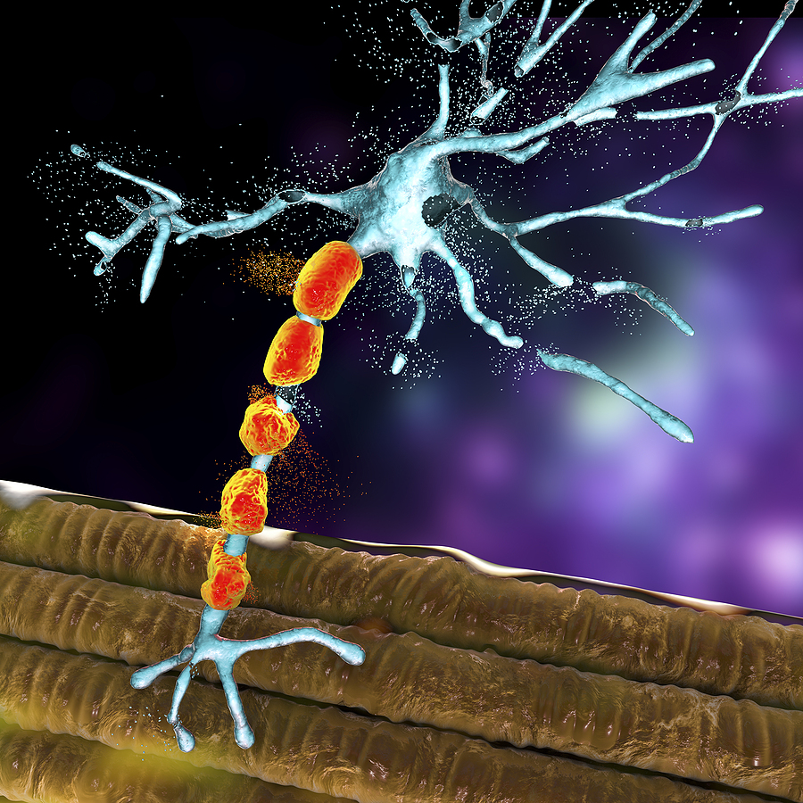 What is Peripheral Neuropathy